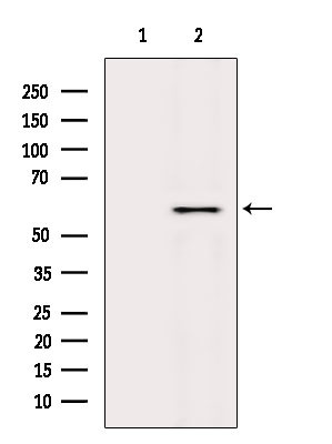 CYP2E1 Antibody in Western Blot (WB)