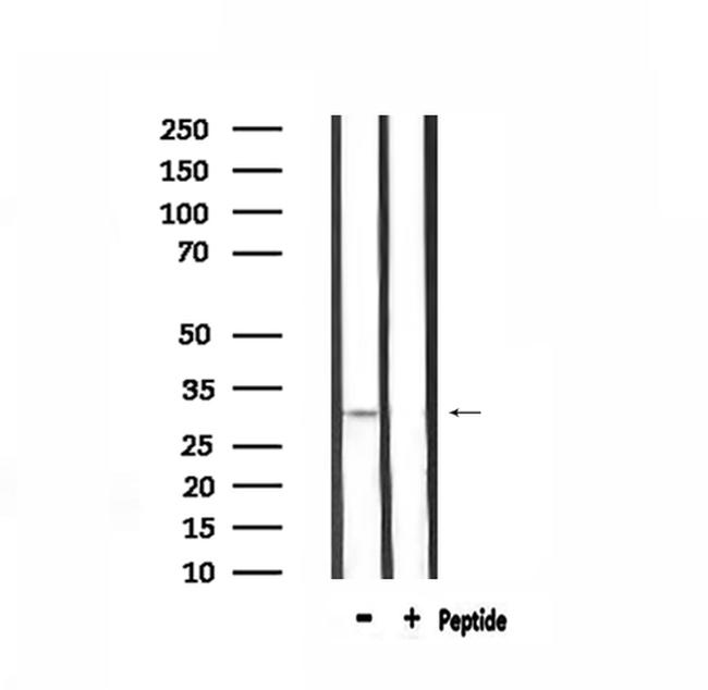 Calponin 2 Antibody in Western Blot (WB)