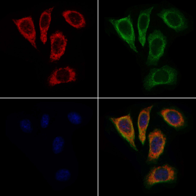 C1QBP Antibody in Immunocytochemistry (ICC/IF)