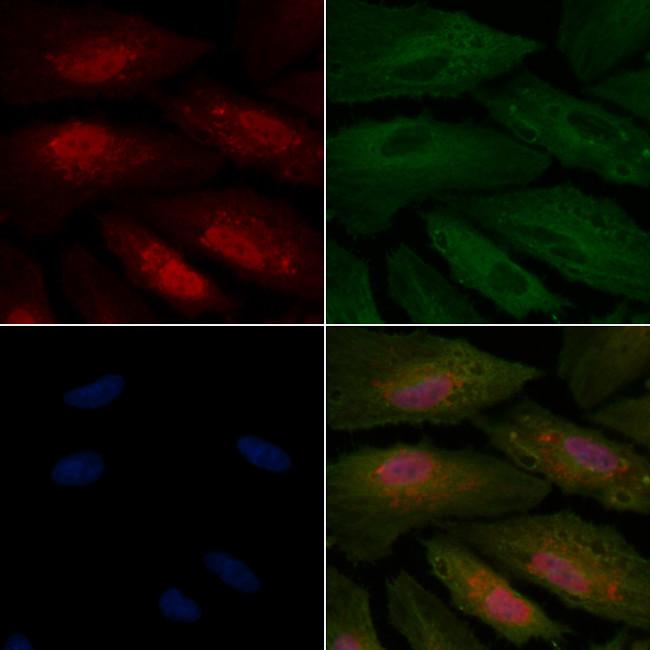 C1QBP Antibody in Immunocytochemistry (ICC/IF)