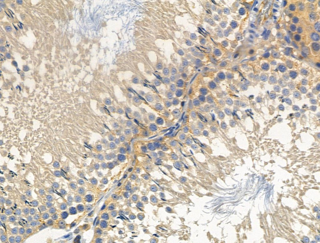 C1QBP Antibody in Immunohistochemistry (Paraffin) (IHC (P))