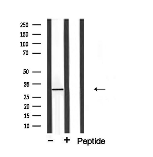 C1QBP Antibody in Western Blot (WB)