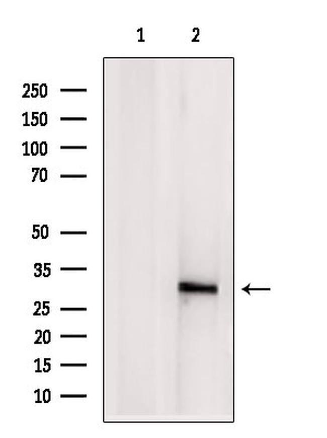 eIF3k Antibody in Western Blot (WB)