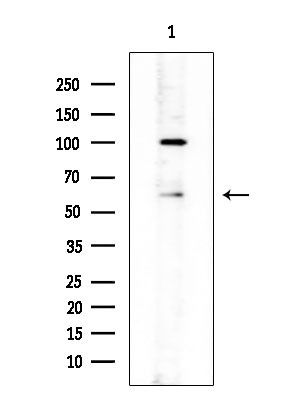 SLU7 Antibody in Western Blot (WB)