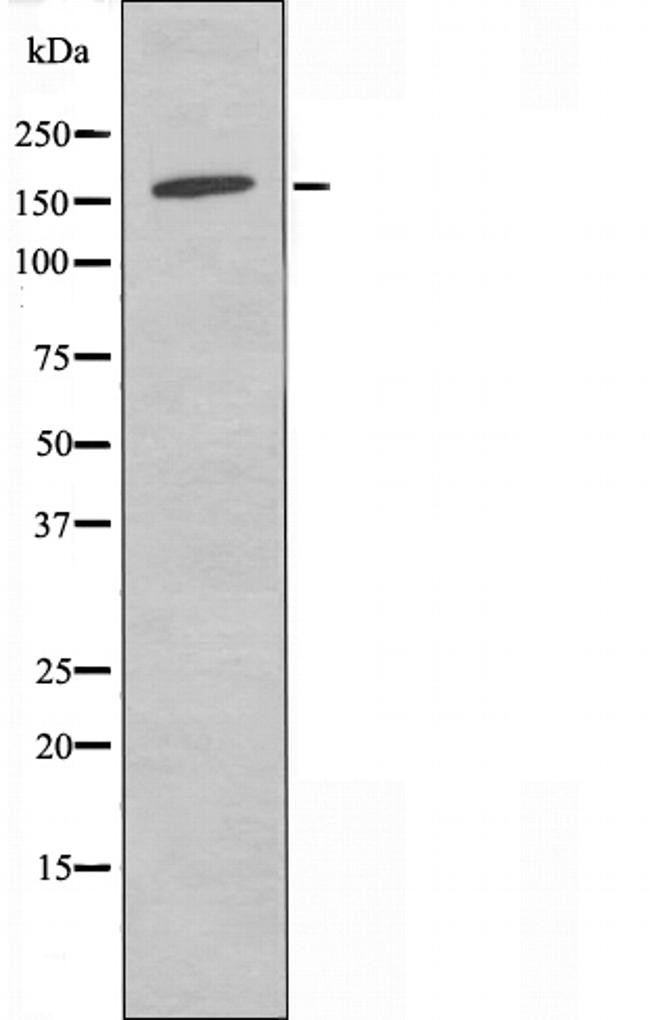 SOS2 Antibody in Western Blot (WB)