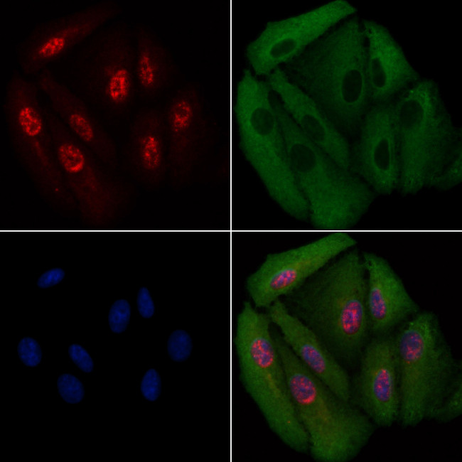 RAD23B Antibody in Immunocytochemistry (ICC/IF)