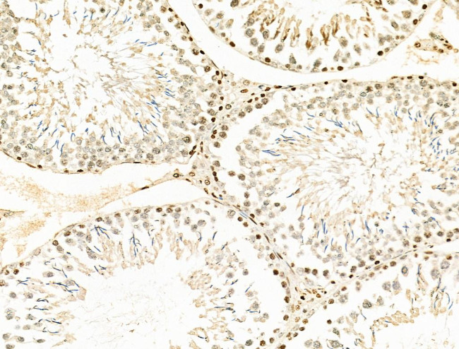 RAD23B Antibody in Immunohistochemistry (Paraffin) (IHC (P))