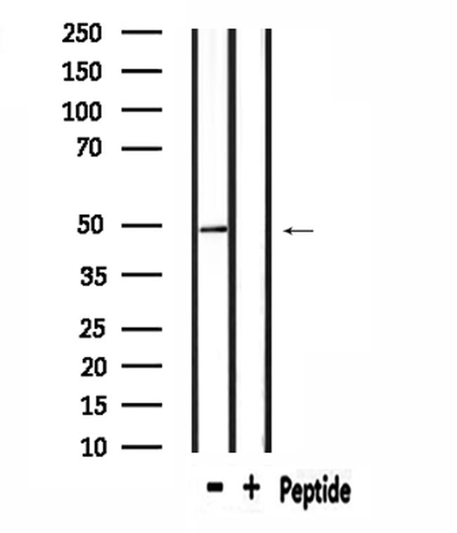 RAD23B Antibody in Western Blot (WB)