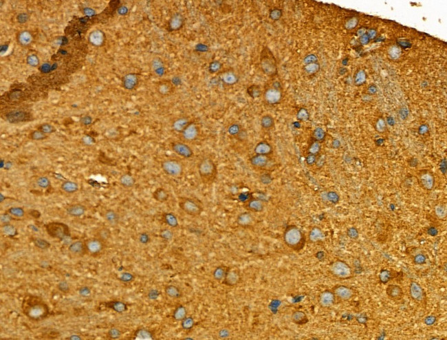 GPR101 Antibody in Immunohistochemistry (Paraffin) (IHC (P))