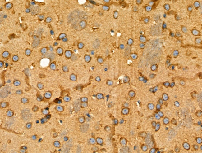 GPR101 Antibody in Immunohistochemistry (Paraffin) (IHC (P))