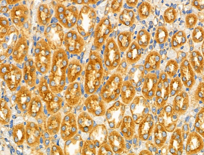 GPR101 Antibody in Immunohistochemistry (Paraffin) (IHC (P))