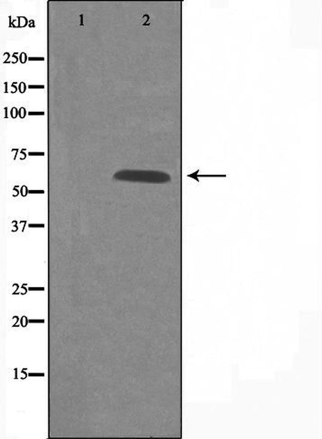 GPR101 Antibody in Western Blot (WB)