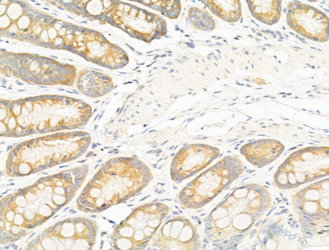 GIPR Antibody in Immunohistochemistry (Paraffin) (IHC (P))