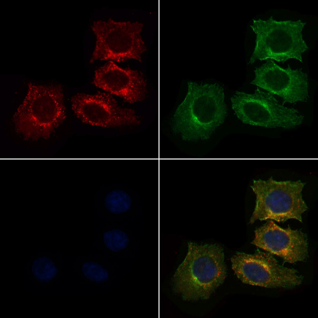 Arp3 Antibody in Immunocytochemistry (ICC/IF)