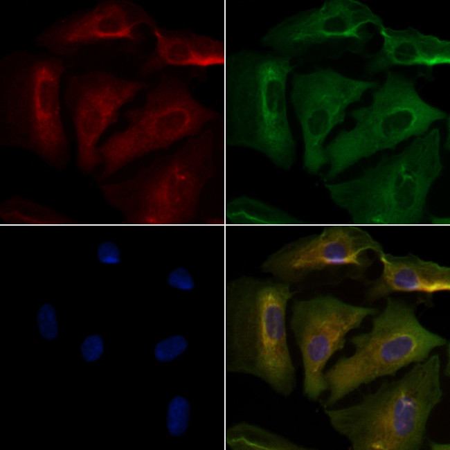 Arp3 Antibody in Immunocytochemistry (ICC/IF)