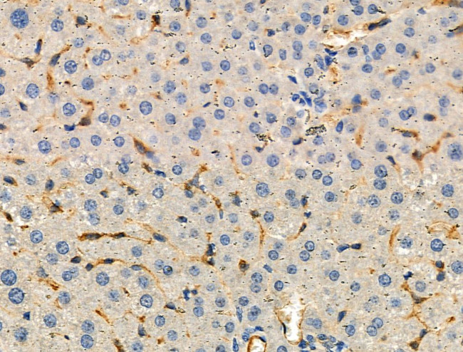 Arp3 Antibody in Immunohistochemistry (Paraffin) (IHC (P))