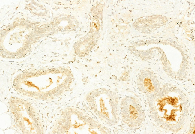 PYCARD Antibody in Immunohistochemistry (Paraffin) (IHC (P))