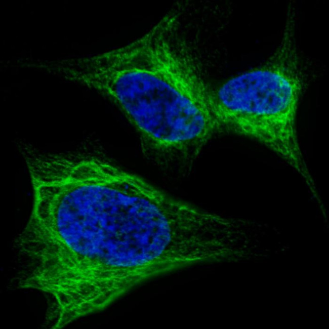 Nestin Antibody in Immunocytochemistry (ICC/IF)