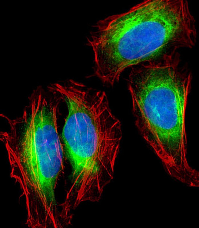 Nestin Antibody in Immunocytochemistry (ICC/IF)