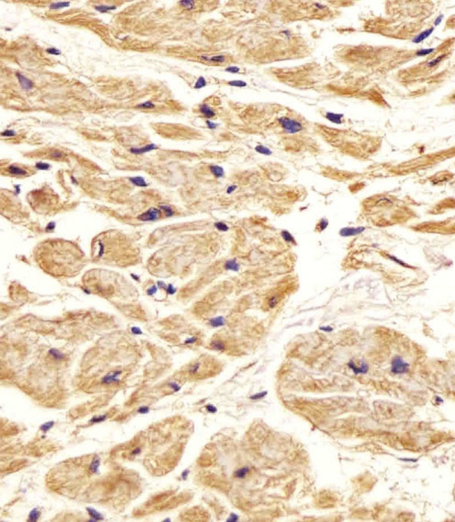 Nestin Antibody in Immunohistochemistry (Paraffin) (IHC (P))