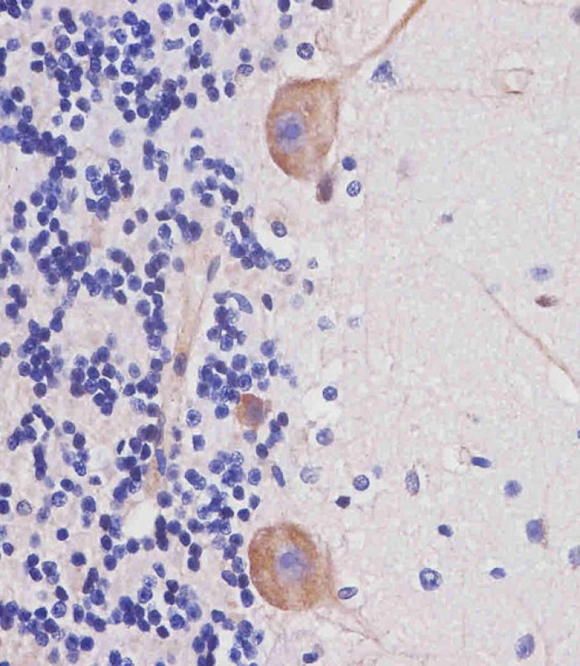 Nestin Antibody in Immunohistochemistry (Paraffin) (IHC (P))