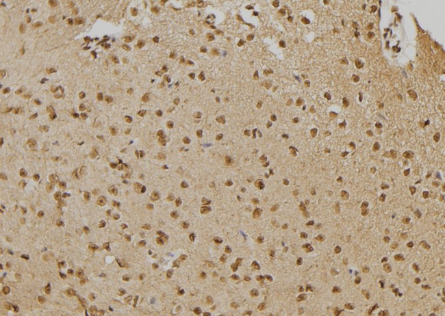 PTPN22 Antibody in Immunohistochemistry (Paraffin) (IHC (P))