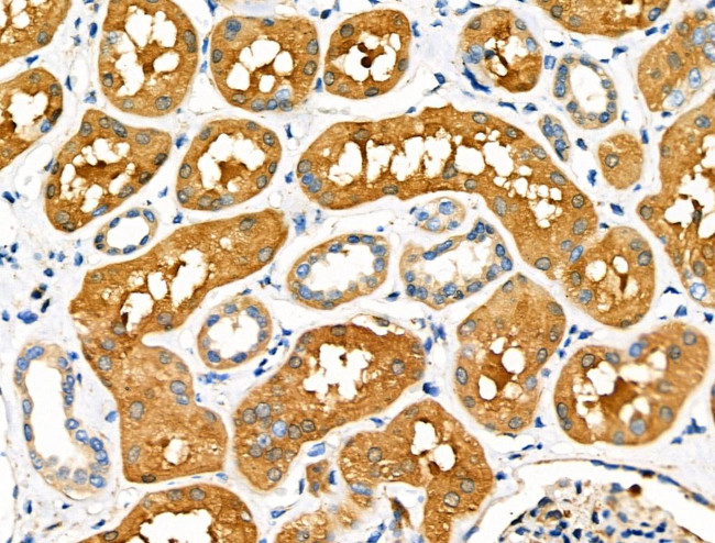 PCK1 Antibody in Immunohistochemistry (Paraffin) (IHC (P))