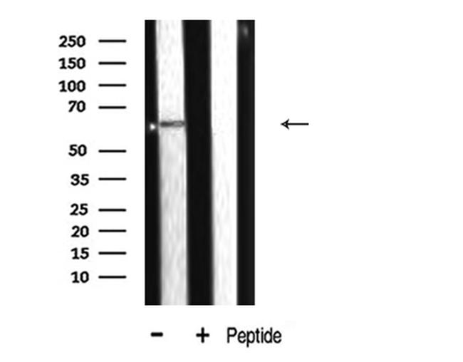 CYP2E1 Antibody in Western Blot (WB)