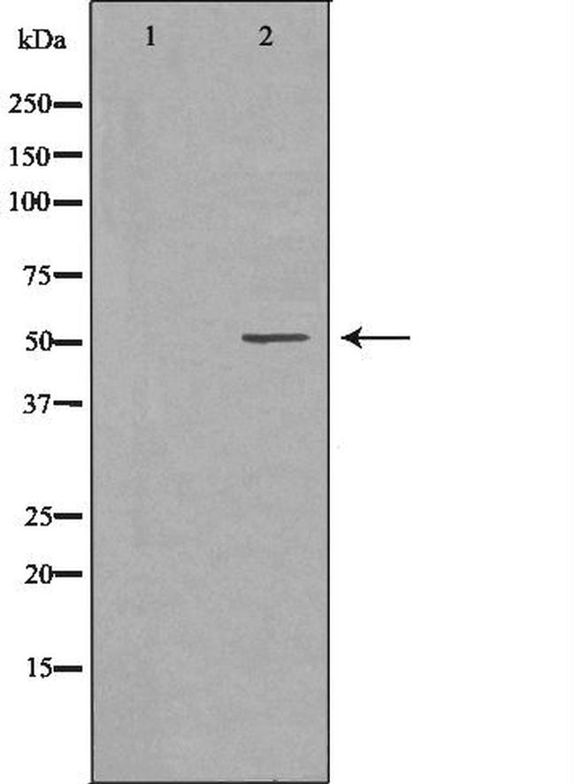 MMP8 Antibody in Western Blot (WB)