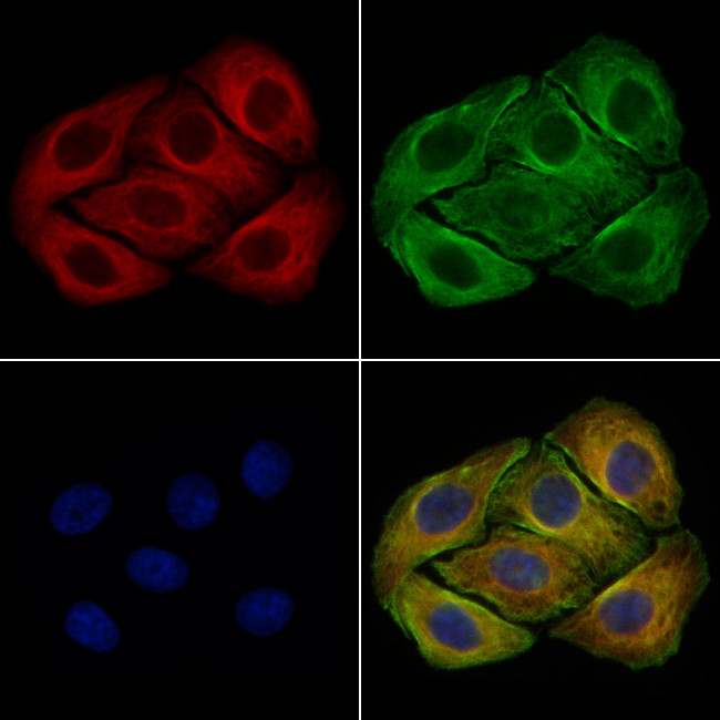 MFN1 Antibody in Immunocytochemistry (ICC/IF)