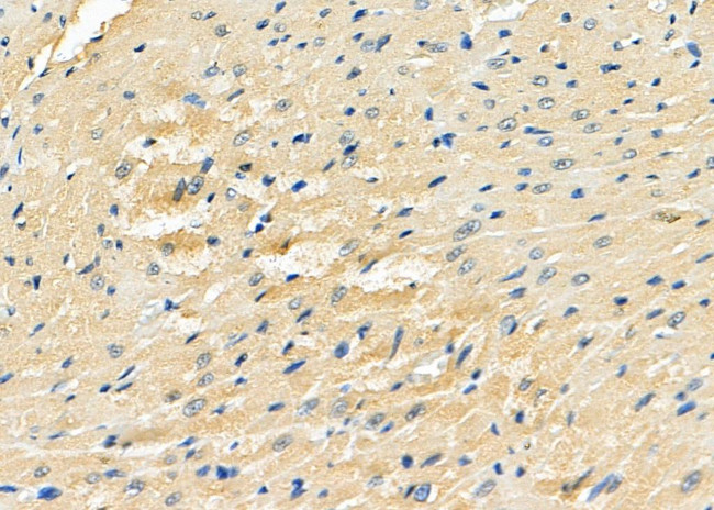 EVL Antibody in Immunohistochemistry (Paraffin) (IHC (P))