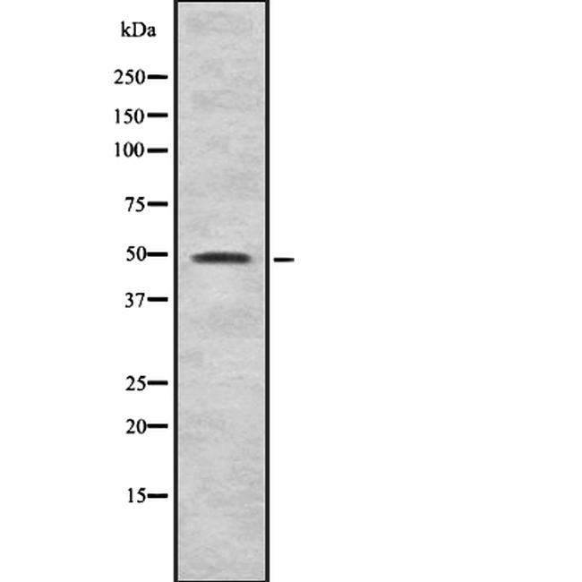 EVL Antibody in Western Blot (WB)