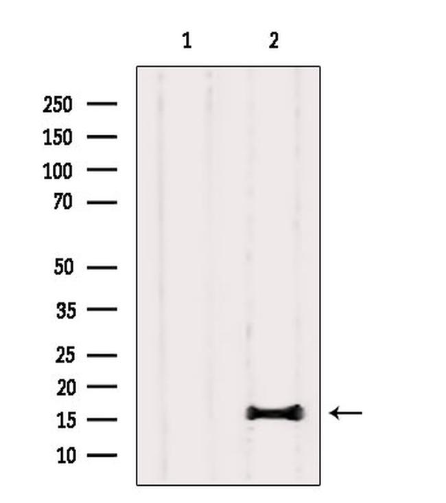 PLA2 Antibody in Western Blot (WB)