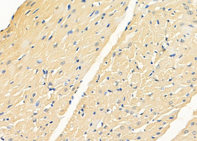 KLHL3 Antibody in Immunohistochemistry (Paraffin) (IHC (P))