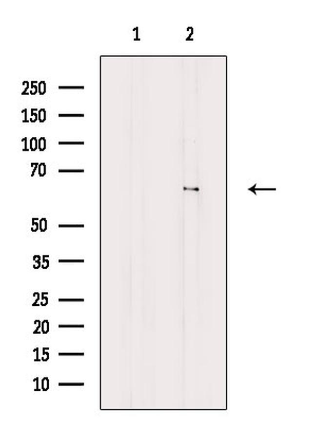 KLHL3 Antibody in Western Blot (WB)