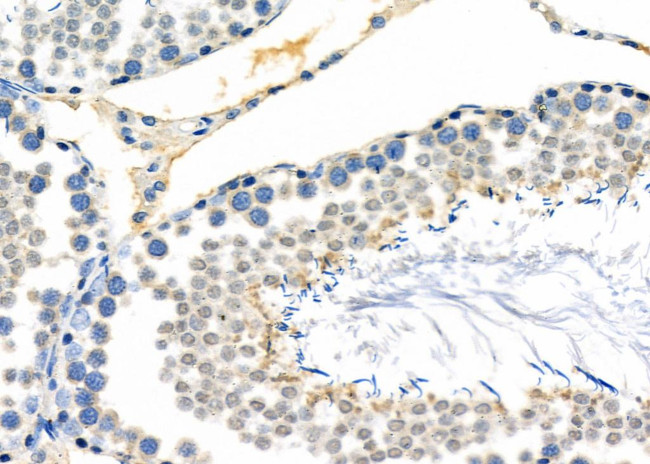 Alpha A Crystallin Antibody in Immunohistochemistry (Paraffin) (IHC (P))