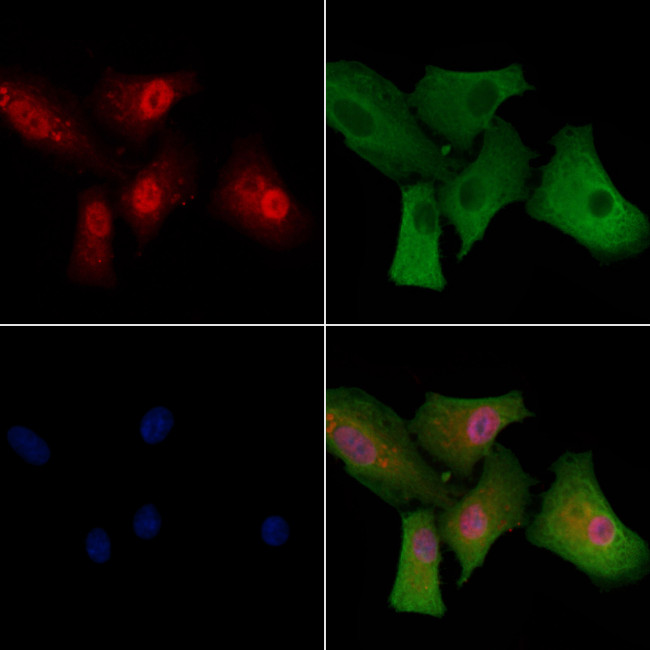 Ataxin 7 Antibody in Immunocytochemistry (ICC/IF)