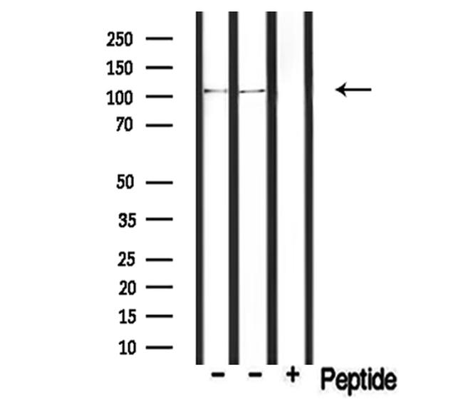 PDE2A Antibody in Western Blot (WB)