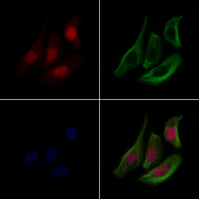 EEF1A2 Antibody in Immunocytochemistry (ICC/IF)