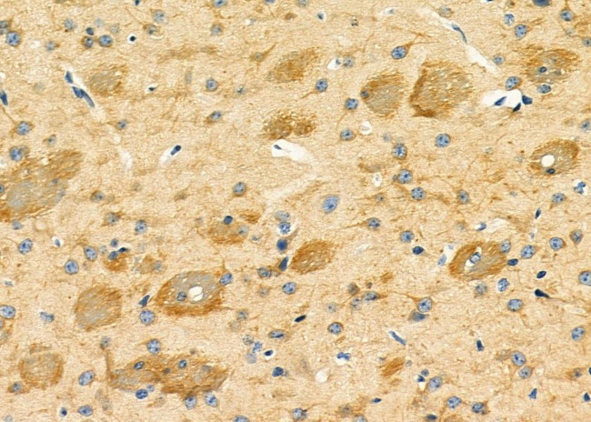 LRP4 Antibody in Immunohistochemistry (Paraffin) (IHC (P))