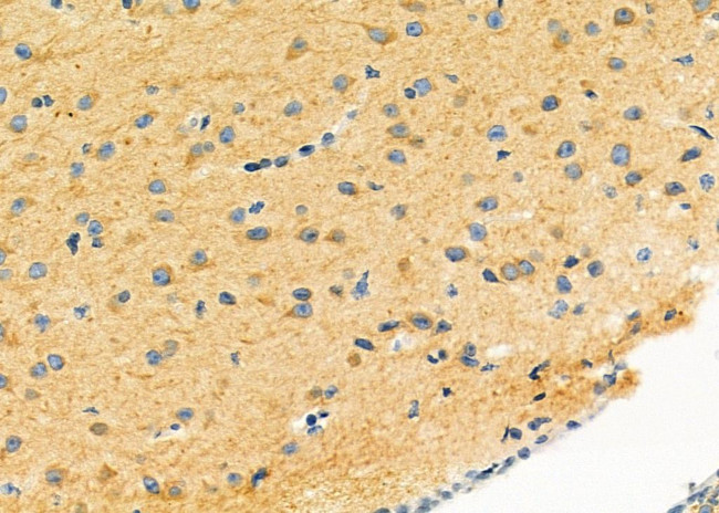 LRP4 Antibody in Immunohistochemistry (Paraffin) (IHC (P))