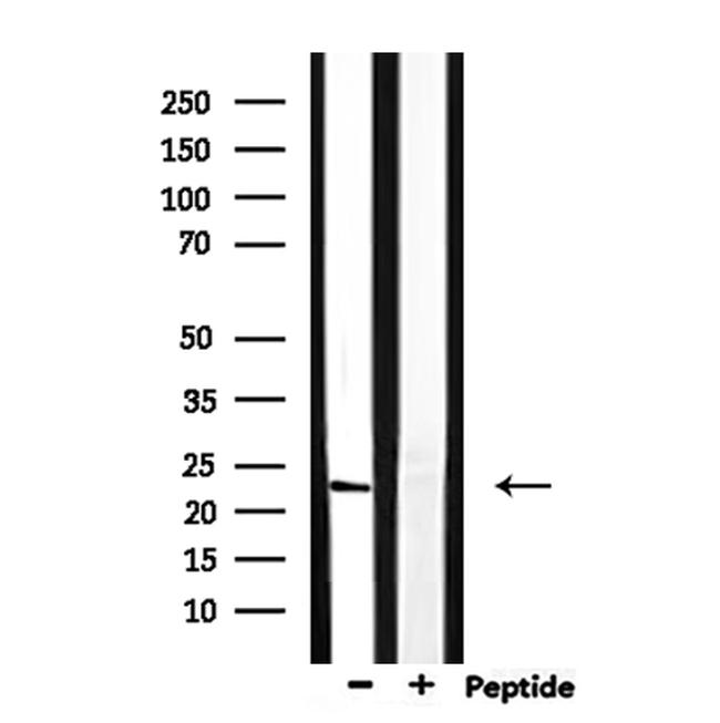 RAB13 Antibody in Western Blot (WB)