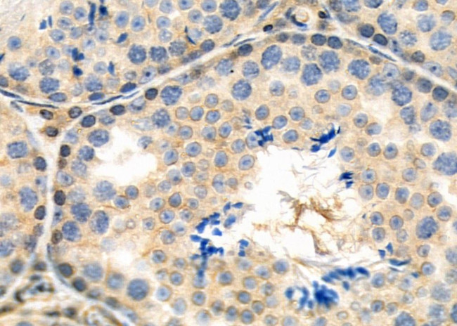 SH3GL3 Antibody in Immunohistochemistry (Paraffin) (IHC (P))