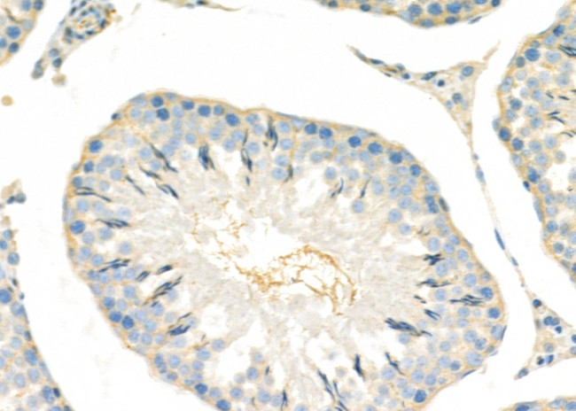 SH3GL3 Antibody in Immunohistochemistry (Paraffin) (IHC (P))