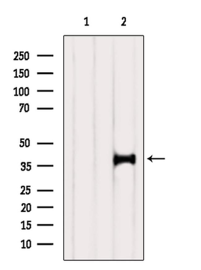 SH3GL3 Antibody in Western Blot (WB)