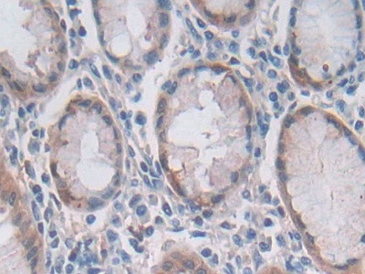 OAS2 Antibody in Immunohistochemistry (Paraffin) (IHC (P))