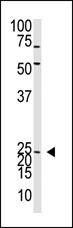 Neurogenin 2 Antibody in Western Blot (WB)