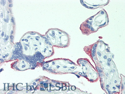 5T4 Antibody in Immunohistochemistry (Paraffin) (IHC (P))