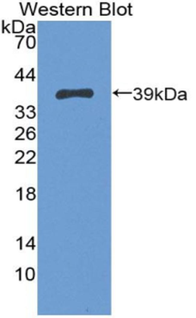 5T4 Antibody in Western Blot (WB)