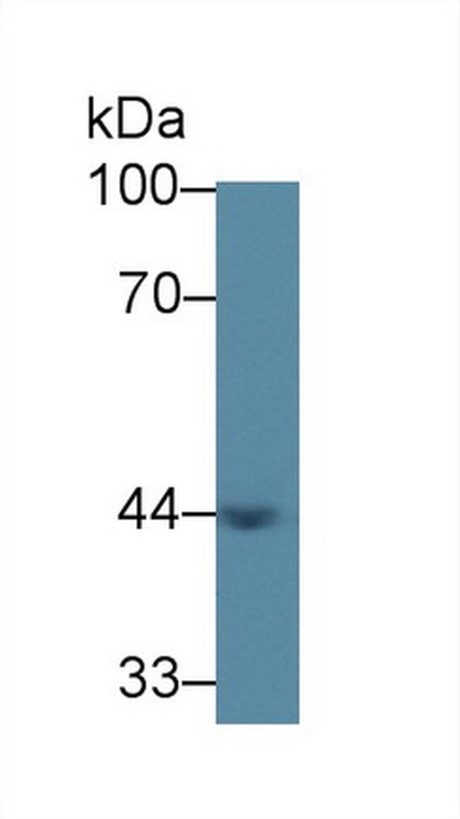 ACAA1 Antibody in Western Blot (WB)